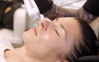 Revify Med Spa’s Microneedling: Transform Your Skin in San Antonio
